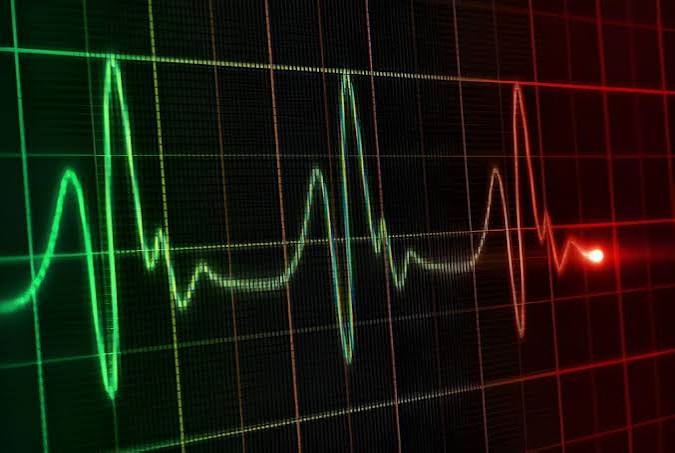 Kalp Damar Görüntülemesi Gerekli Olmadıkça Yapılmamalıdır
